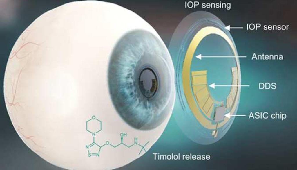 Lentillas con microchips para controlar patologías 