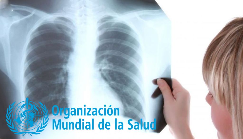 Tuberculosis vuelve a ser principal causa de muerte por enfermedad infecciosa 