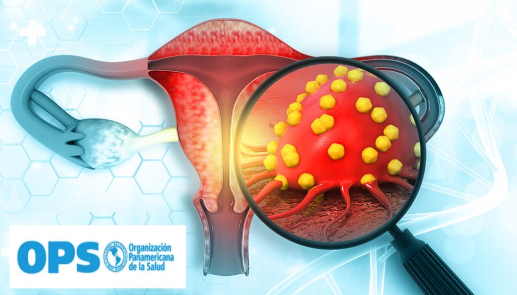 América Latina y el Caribe: Segunda región con mayor casos y muertes por cáncer cervicouterino 